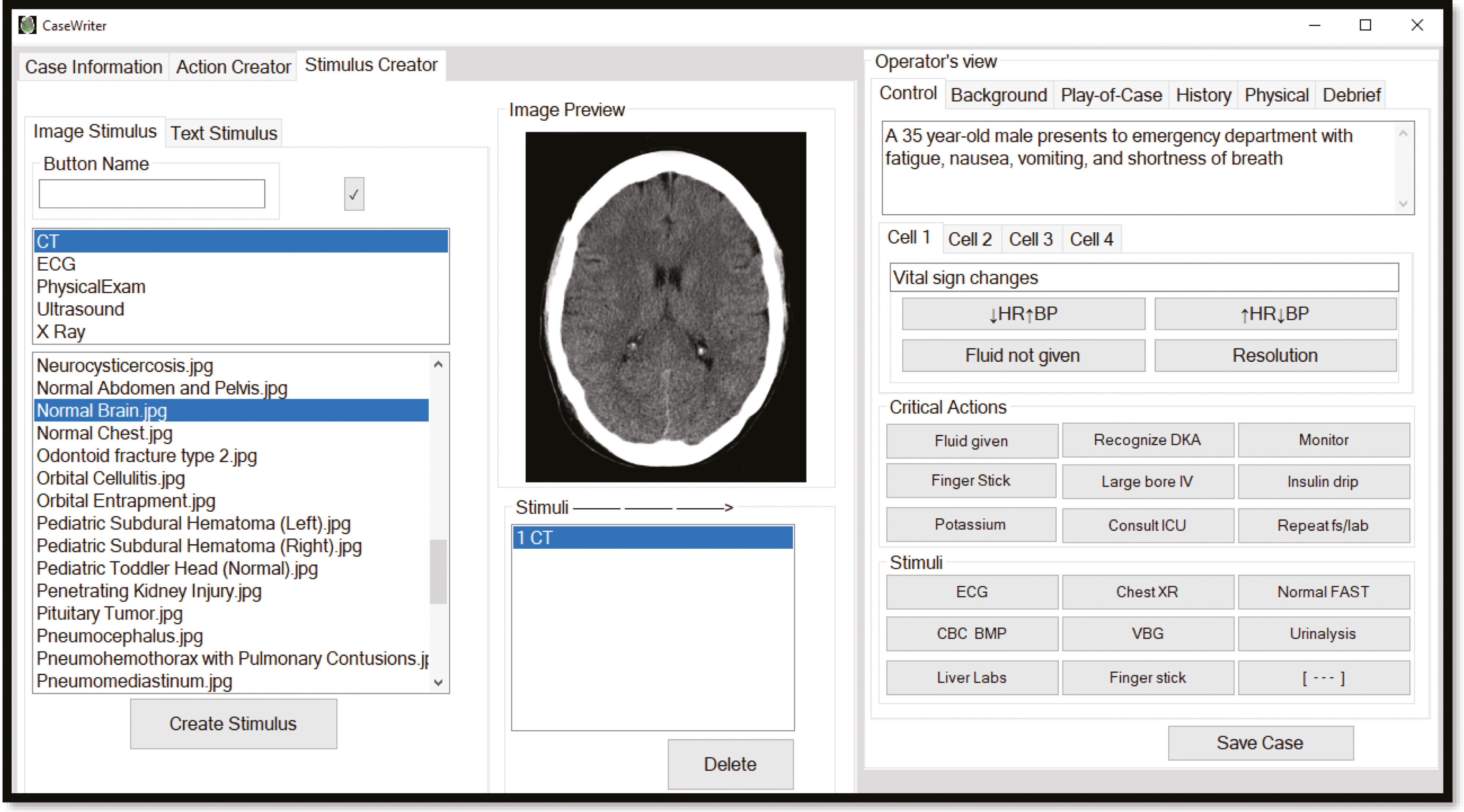 Med Sim Studio allows authors to develop customized cases which include everything a simulation educator requires to teach: pre-scripted vital signs, embedded stimulus images and laboratory values, critical action tracking and case information (background, play-of-case, history, physical and a debrief guide). Cases can be shared from user to user easily via a centralized database, or sent through e-mail or portable digital media.