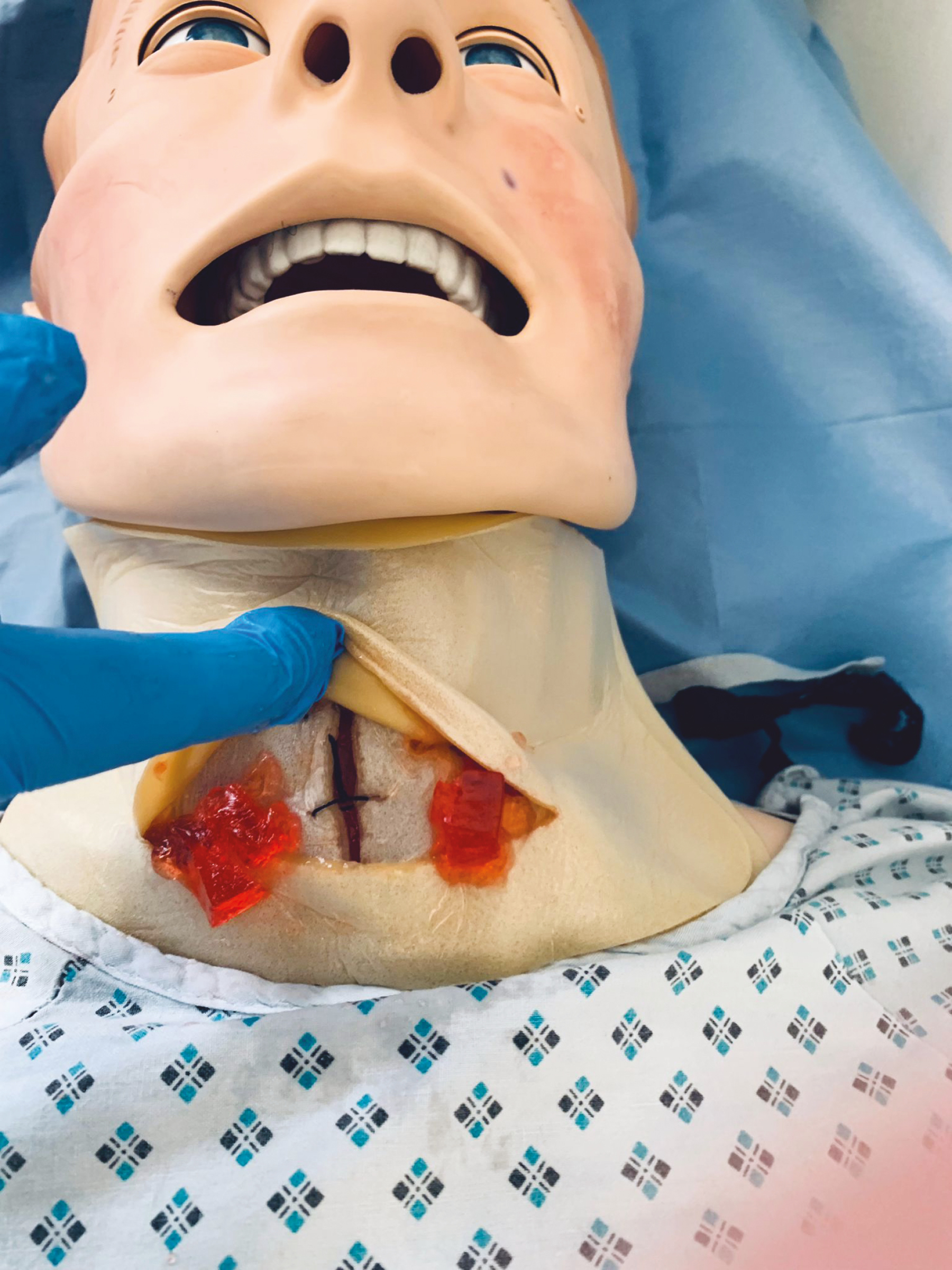 Manikin with neck haematoma demonstrated by two layers of dressings sutured together and use of jelly to simulate clotted blood.
